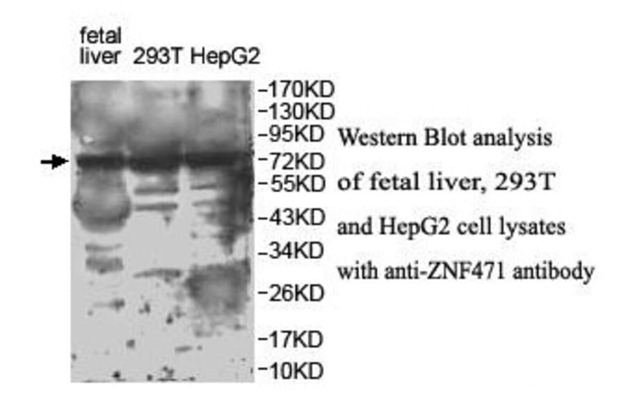 ZNF471 Antibody from Signalway Antibody (39901) - Antibodies.com