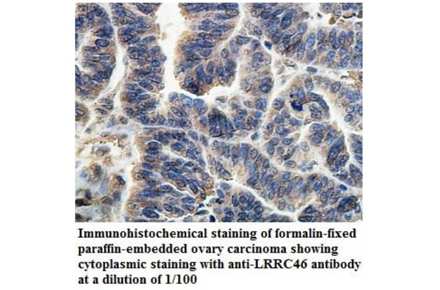 LRRC46 Antibody from Signalway Antibody (39902) - Antibodies.com