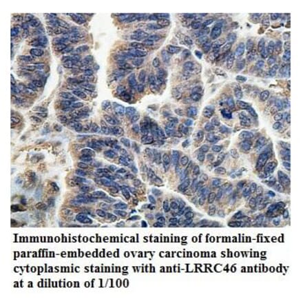 LRRC46 Antibody from Signalway Antibody (39902) - Antibodies.com