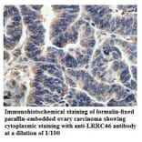 LRRC46 Antibody from Signalway Antibody (39902) - Antibodies.com