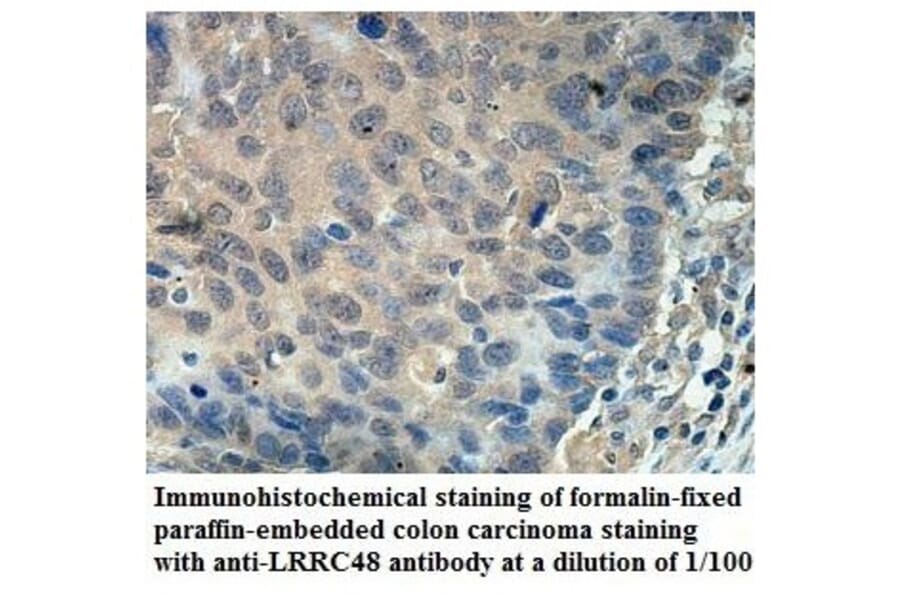 LRRC48 Antibody from Signalway Antibody (39903) - Antibodies.com