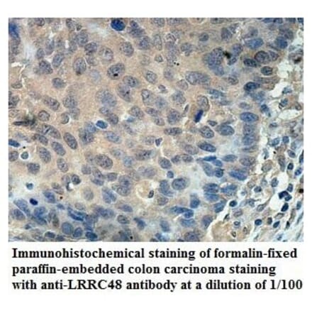 LRRC48 Antibody from Signalway Antibody (39903) - Antibodies.com