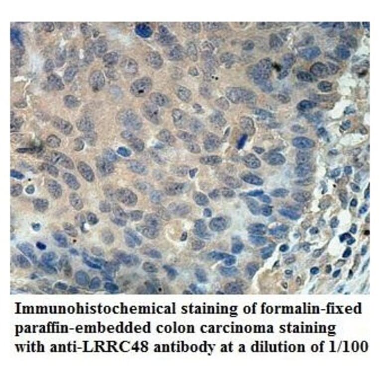 LRRC48 Antibody from Signalway Antibody (39903) - Antibodies.com