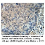 LRRC48 Antibody from Signalway Antibody (39903) - Antibodies.com