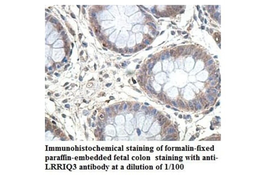 LRRIQ3 Antibody from Signalway Antibody (39904) - Antibodies.com