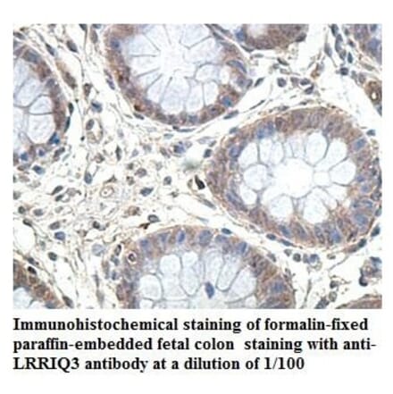 LRRIQ3 Antibody from Signalway Antibody (39904) - Antibodies.com