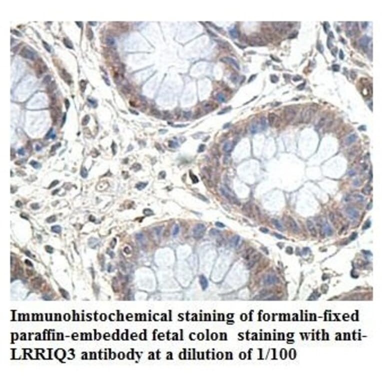 LRRIQ3 Antibody from Signalway Antibody (39904) - Antibodies.com