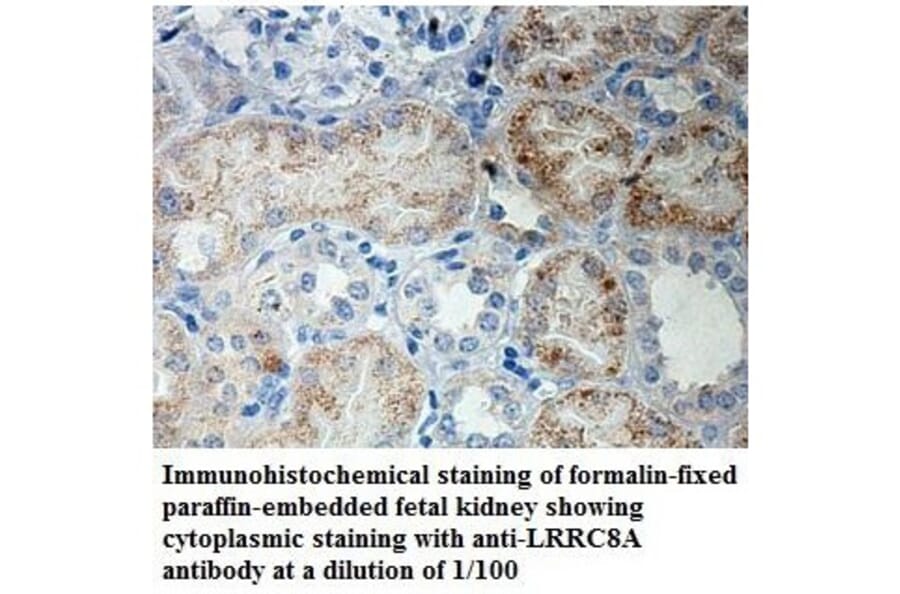 LRRC8A Antibody from Signalway Antibody (39905) - Antibodies.com