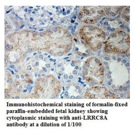 LRRC8A Antibody from Signalway Antibody (39905) - Antibodies.com