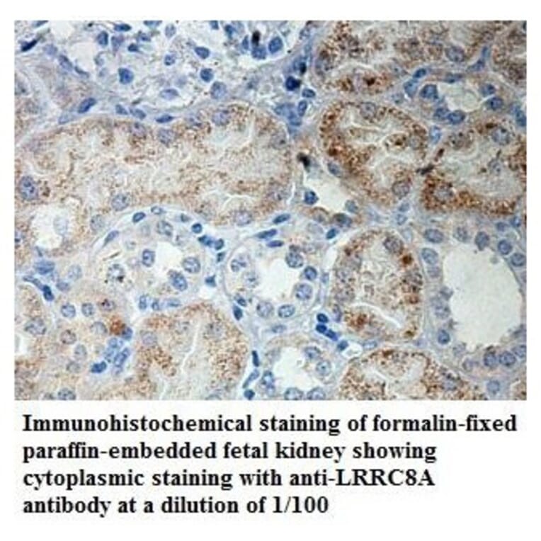 LRRC8A Antibody from Signalway Antibody (39905) - Antibodies.com