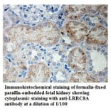 LRRC8A Antibody from Signalway Antibody (39905) - Antibodies.com