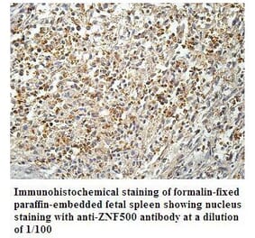 ZNF500 Antibody from Signalway Antibody (39910) - Antibodies.com