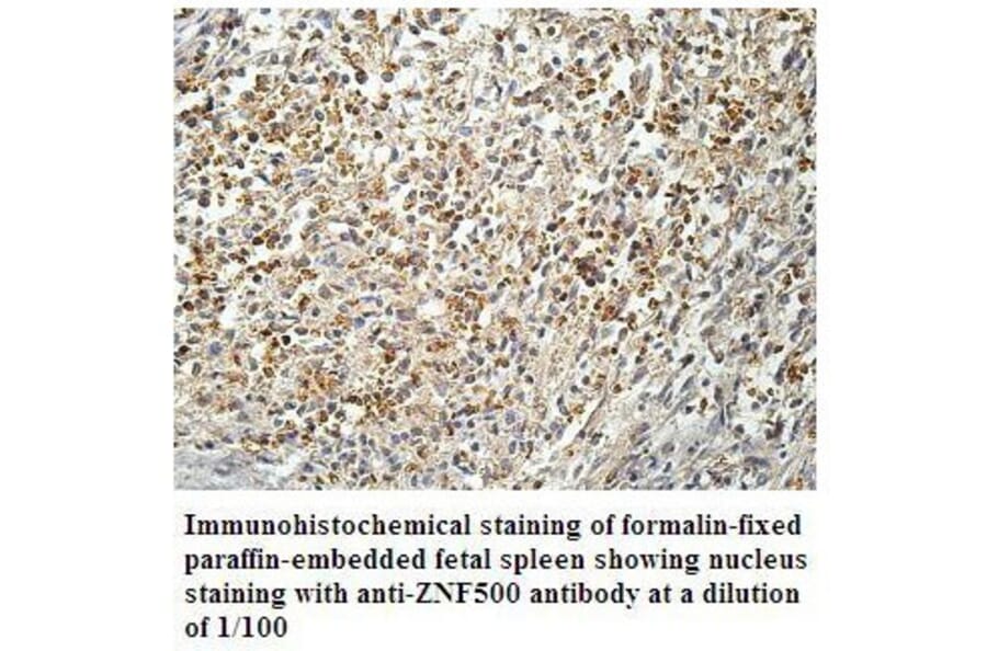 ZNF500 Antibody from Signalway Antibody (39910) - Antibodies.com