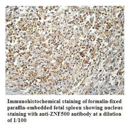 ZNF500 Antibody from Signalway Antibody (39910) - Antibodies.com