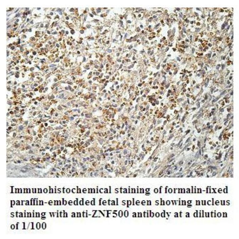 ZNF500 Antibody from Signalway Antibody (39910) - Antibodies.com
