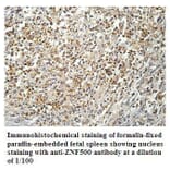 ZNF500 Antibody from Signalway Antibody (39910) - Antibodies.com