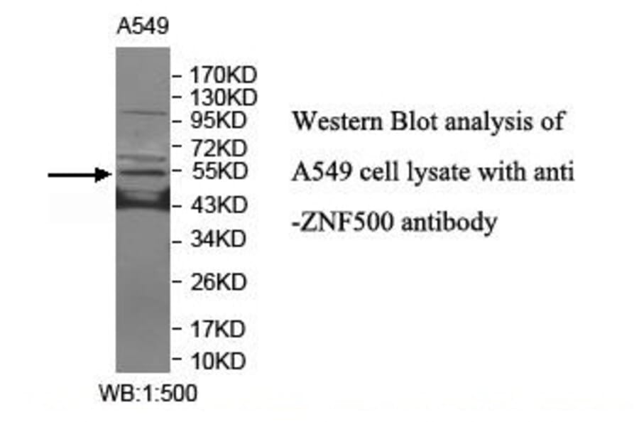 ZNF500 Antibody from Signalway Antibody (39910) - Antibodies.com