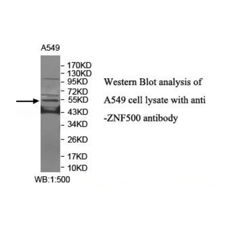 ZNF500 Antibody from Signalway Antibody (39910) - Antibodies.com