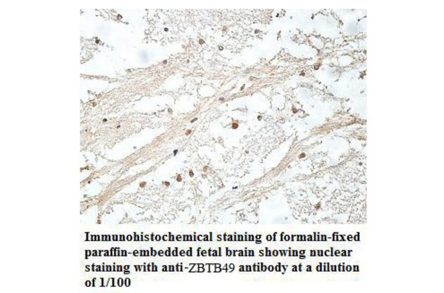 ZBTB49 Antibody from Signalway Antibody (39911) - Antibodies.com