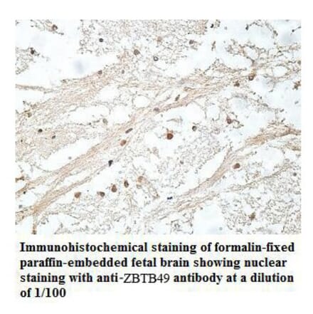 ZBTB49 Antibody from Signalway Antibody (39911) - Antibodies.com