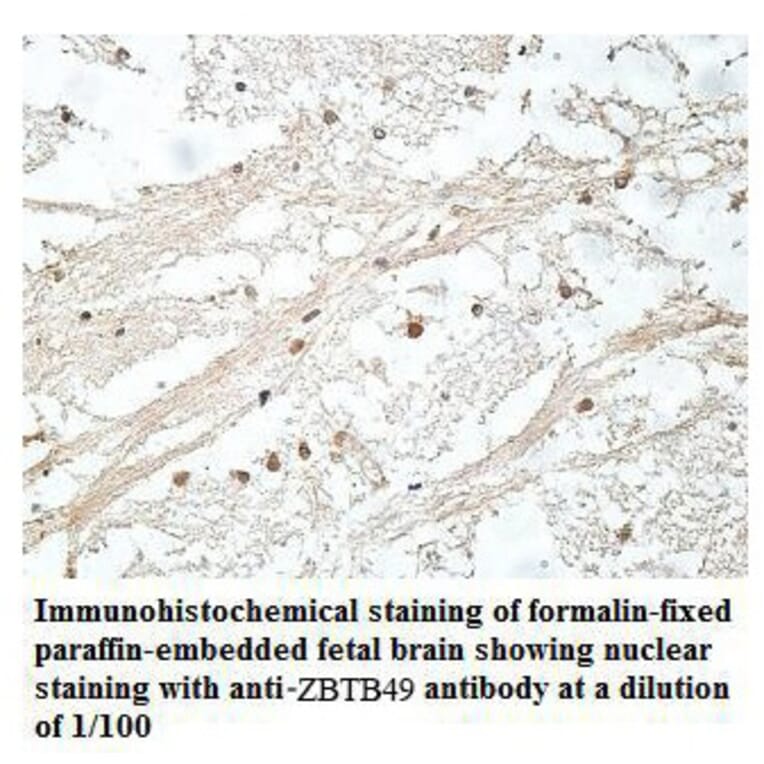 ZBTB49 Antibody from Signalway Antibody (39911) - Antibodies.com