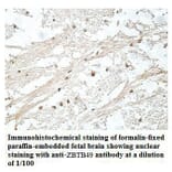 ZBTB49 Antibody from Signalway Antibody (39911) - Antibodies.com