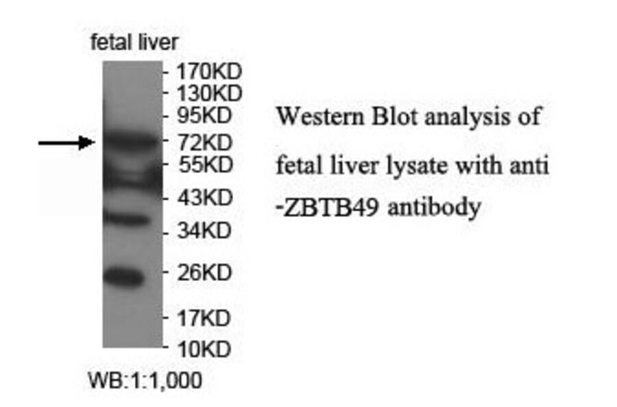 ZBTB49 Antibody from Signalway Antibody (39911) - Antibodies.com