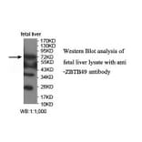 ZBTB49 Antibody from Signalway Antibody (39911) - Antibodies.com