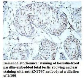 ZNF597 Antibody from Signalway Antibody (39912) - Antibodies.com