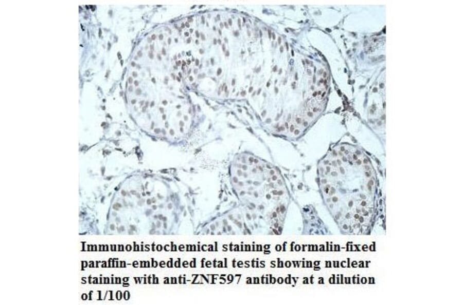 ZNF597 Antibody from Signalway Antibody (39912) - Antibodies.com