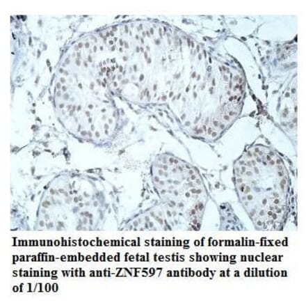 ZNF597 Antibody from Signalway Antibody (39912) - Antibodies.com