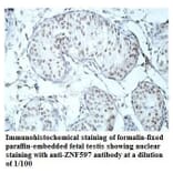 ZNF597 Antibody from Signalway Antibody (39912) - Antibodies.com