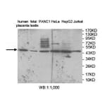 ZNF597 Antibody from Signalway Antibody (39912) - Antibodies.com