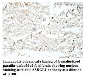 ASRGL1 Antibody from Signalway Antibody (39915) - Antibodies.com