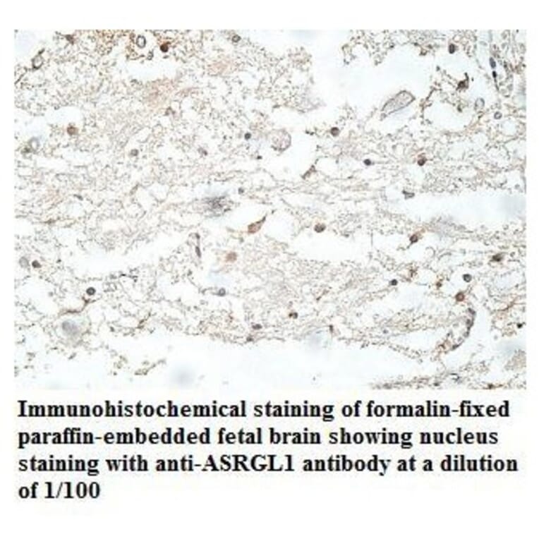 ASRGL1 Antibody from Signalway Antibody (39915) - Antibodies.com