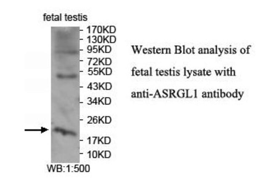 ASRGL1 Antibody from Signalway Antibody (39915) - Antibodies.com