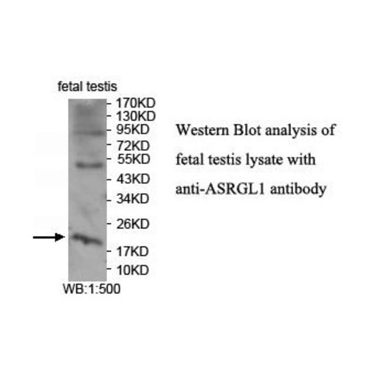 ASRGL1 Antibody from Signalway Antibody (39915) - Antibodies.com