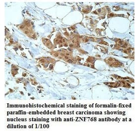 ZNF768 Antibody from Signalway Antibody (39918) - Antibodies.com