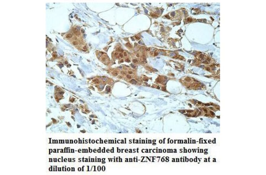 ZNF768 Antibody from Signalway Antibody (39918) - Antibodies.com