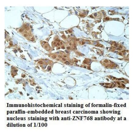 ZNF768 Antibody from Signalway Antibody (39918) - Antibodies.com