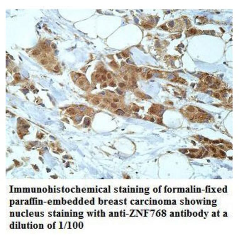 ZNF768 Antibody from Signalway Antibody (39918) - Antibodies.com