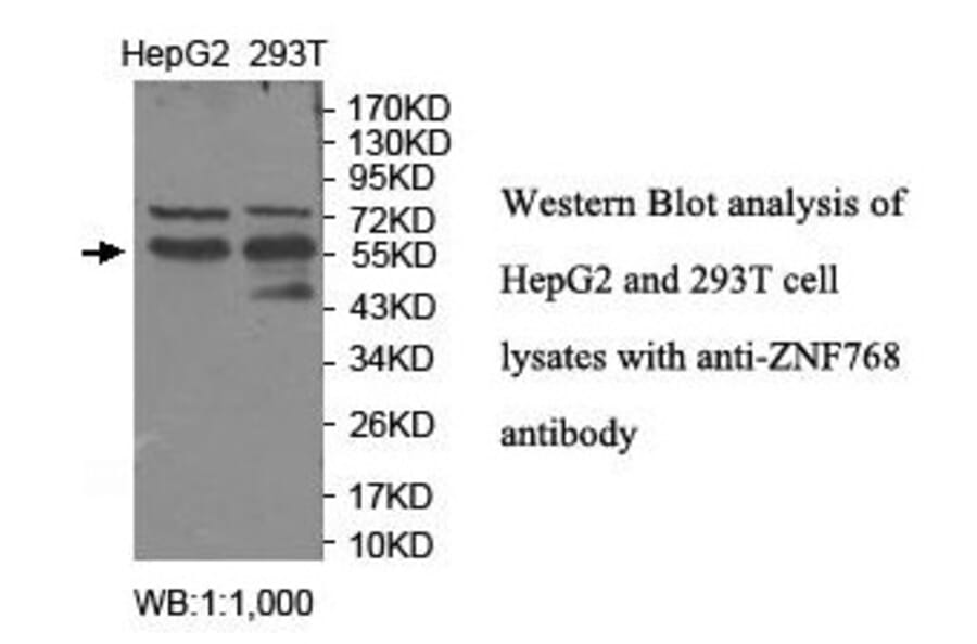 ZNF768 Antibody from Signalway Antibody (39918) - Antibodies.com