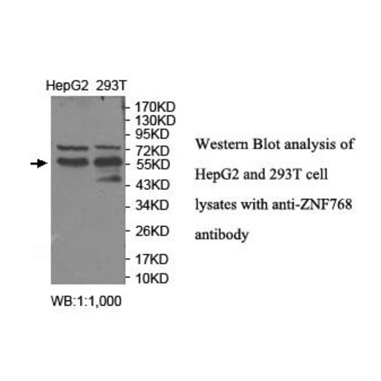 ZNF768 Antibody from Signalway Antibody (39918) - Antibodies.com
