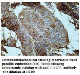 EIF2C3 Antibody from Signalway Antibody (39952) - Antibodies.com