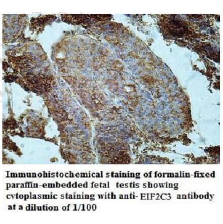EIF2C3 Antibody from Signalway Antibody (39952) - Antibodies.com