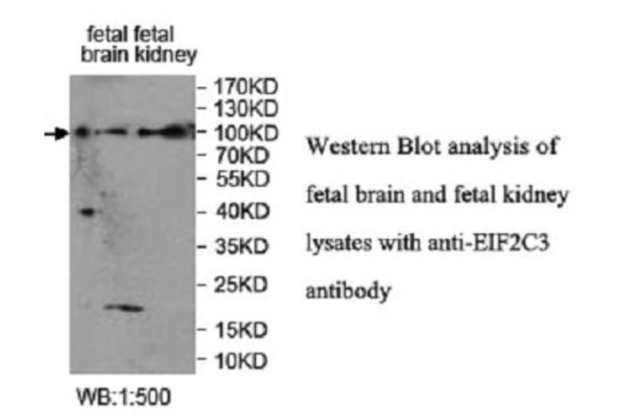 EIF2C3 Antibody from Signalway Antibody (39952) - Antibodies.com