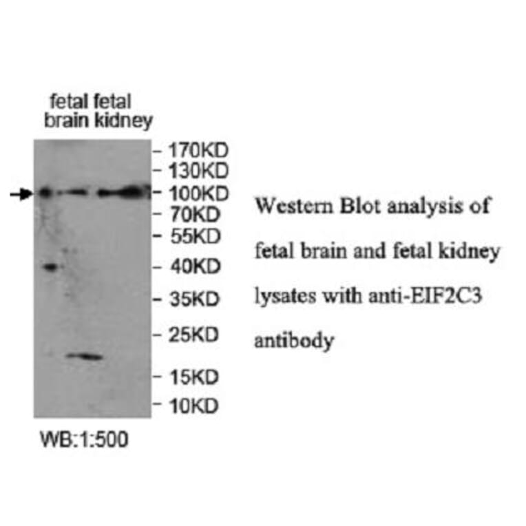 EIF2C3 Antibody from Signalway Antibody (39952) - Antibodies.com