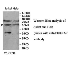 CHRNA9 Antibody from Signalway Antibody (39956) - Antibodies.com