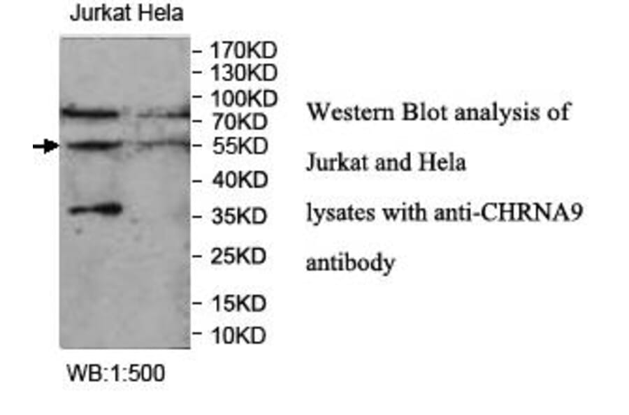 CHRNA9 Antibody from Signalway Antibody (39956) - Antibodies.com