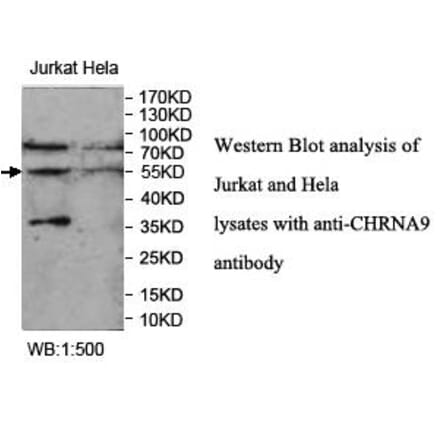 CHRNA9 Antibody from Signalway Antibody (39956) - Antibodies.com